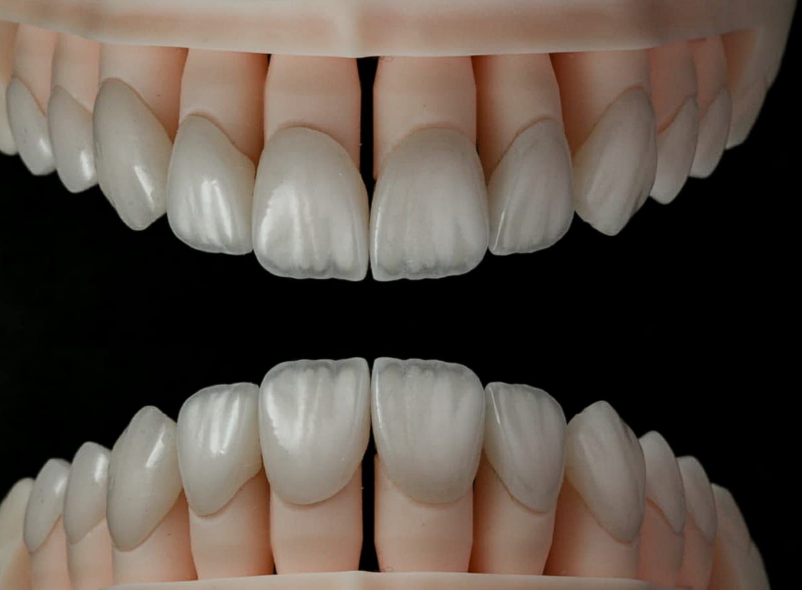 Central incisors