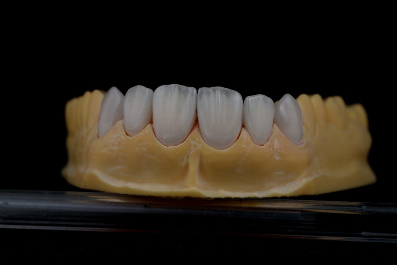 Incisal detail