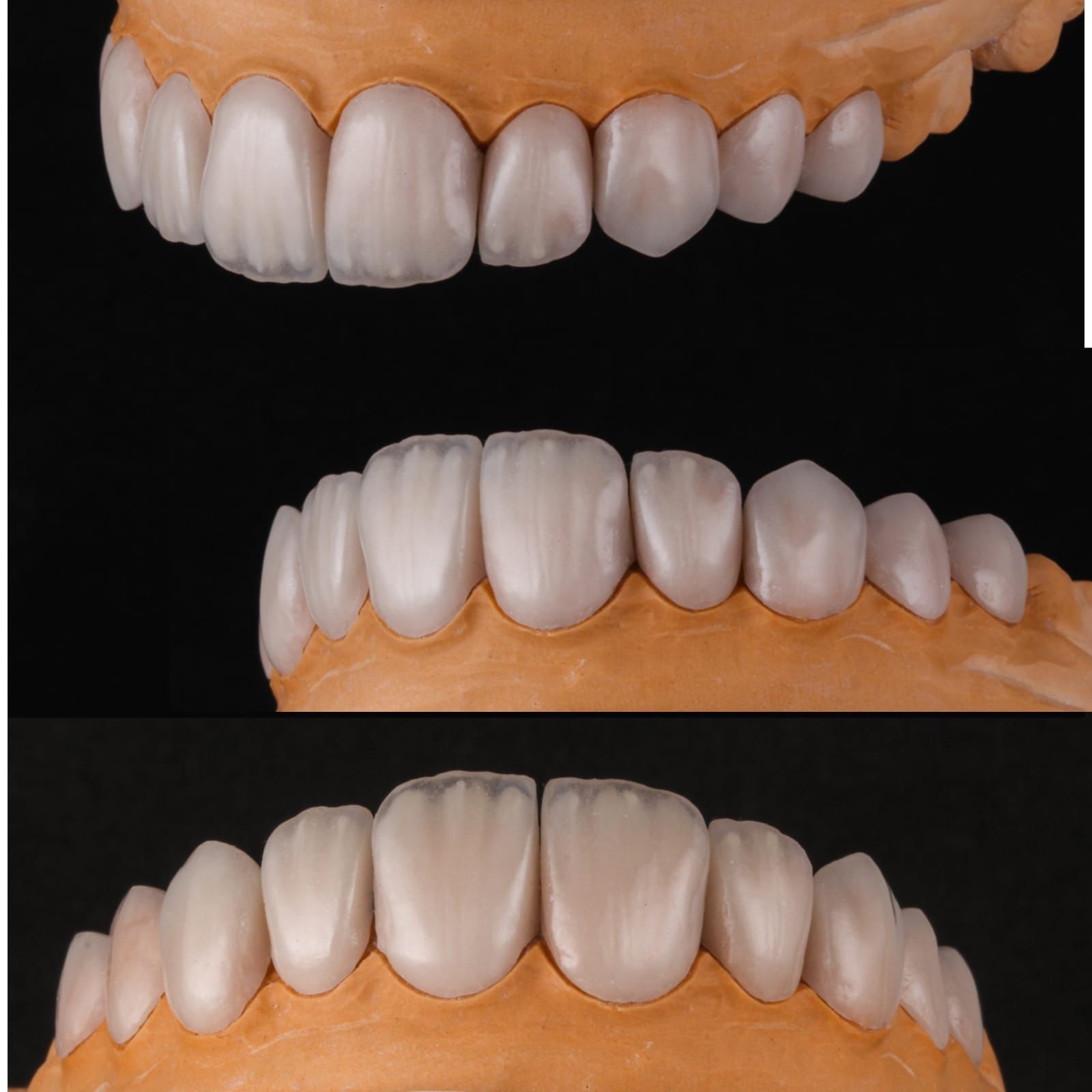 Multi-angle study